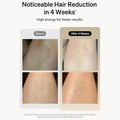 Professional Laser Epilator IPL Hair Removal Body Bikini Leg Depilatory Devic 900,000 Flashes 5 Levels Epilator Painless Electric Epilator Machine Doba