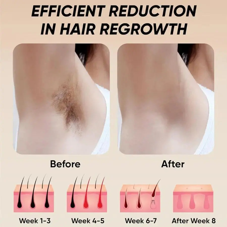 Professional Laser Epilator IPL Hair Removal Body Bikini Leg Depilatory Devic 900,000 Flashes 5 Levels Epilator Painless Electric Epilator Machine Doba